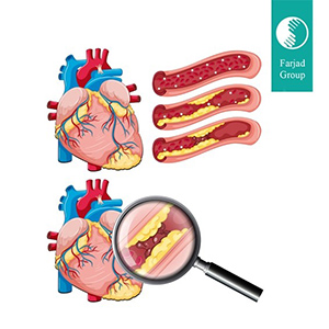 Cholesterol Test